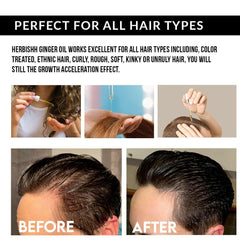 Exotic Ginger Essential Hair Oil - Herbishh Before After