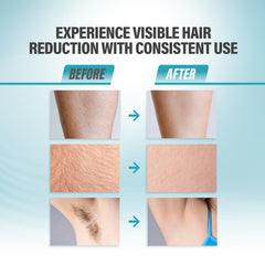 Herbishh IPL Laser Hair Removal Device