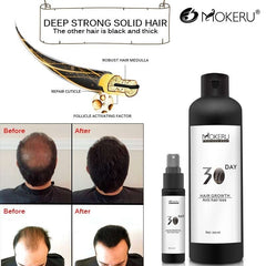 Best hair oil for growth