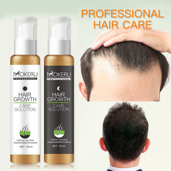 Fast Hair Regrowth Treatment Spray Serum | Hair Care Solutions Pro Gro ...